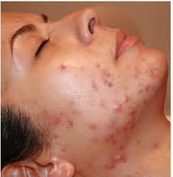 images - 2020-11-09T191523.458 (1)